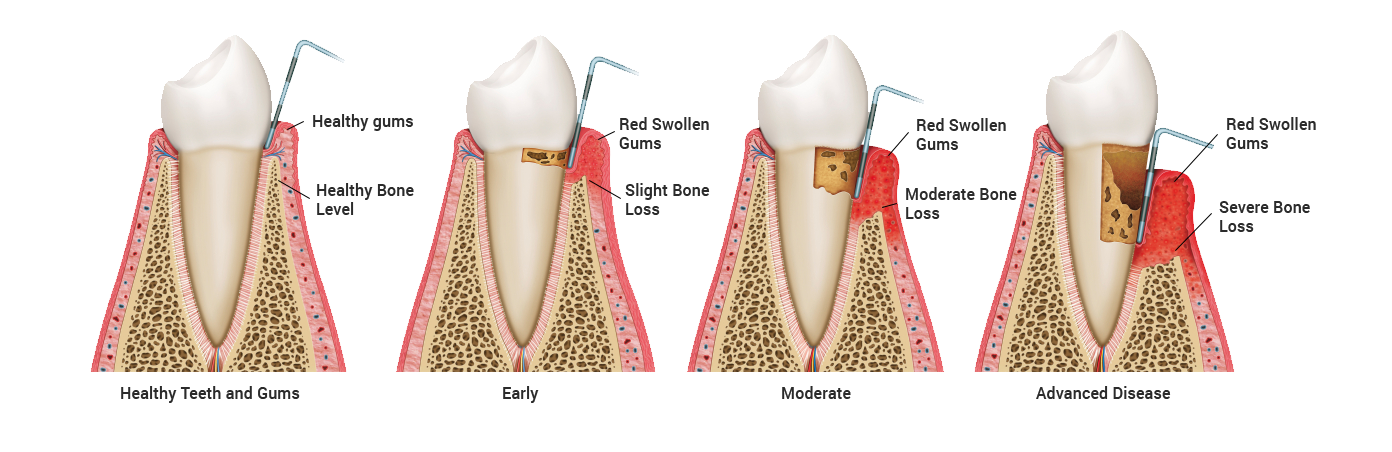 Periodontics Bexleyheath